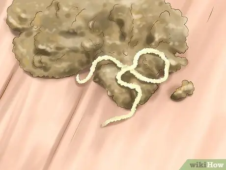 Identify Worms in a Cat Step 10