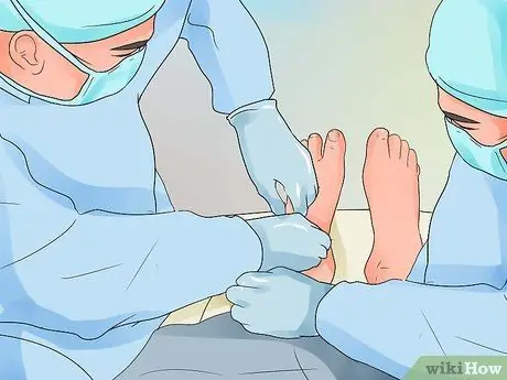 Heal a Broken Toe Step 8