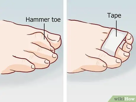 Straighten Toes Step 11