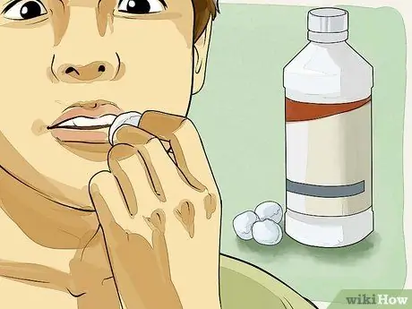 Tanggalin ang isang Cold Sore sa Mga remedyo sa Bahay Hakbang 1