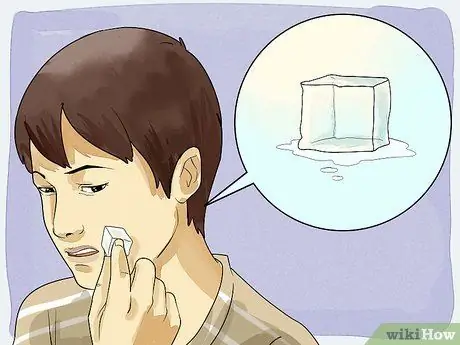 Tanggalin ang isang Cold Sore sa Mga remedyo sa Bahay Hakbang 3