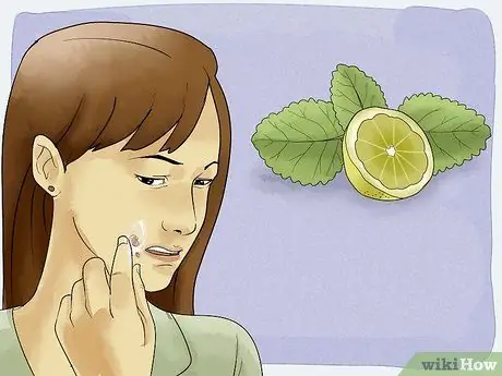 Get Rid of a Cold Sore with Home Remedies Step 5