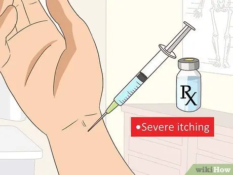 Behandla No -See -Um Bites Steg 13