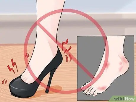 Prevent Foot Blisters Step 2