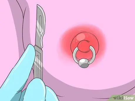 Treat an Infected Nipple Piercing Step 11