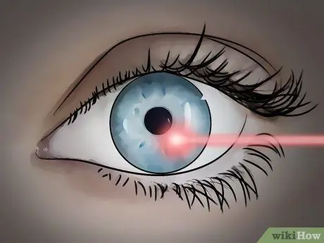 Get Rid of Eye Floaters Step 12