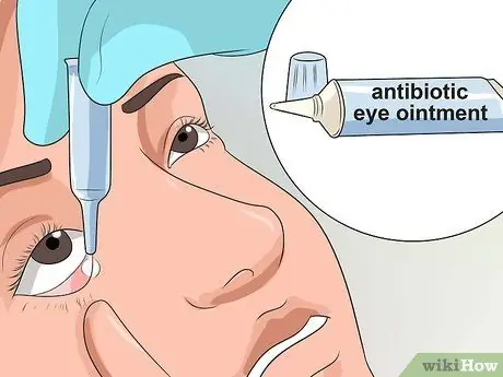 Singkirkan Pink Eye Fast Step 10