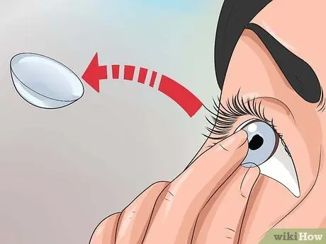 Singkirkan Pink Eye Fast Step 7