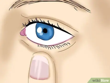 Take Out Contact Lenses Without Touching Your Eye Step 6