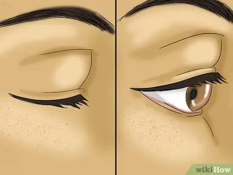 Take Out Contact Lenses Without Touching Your Eye Step 8