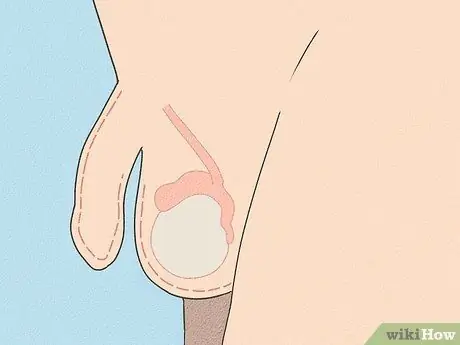 Tell if You Have Hit Puberty (Boys) Step 1