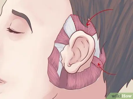 Wiggle Your Ears Step 1