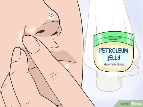 Heal Nose Sores Step 6