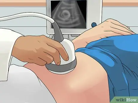 Know if You Have an Ovarian Cyst Step 8