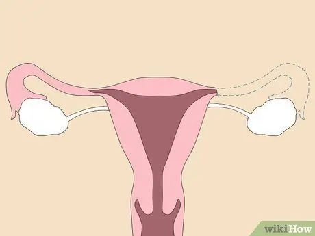 Unblock Fallopian Tubes Naturally Step 5