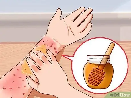 Gumamit ng Honey bilang isang Paksa Antibiotic na Hakbang 11