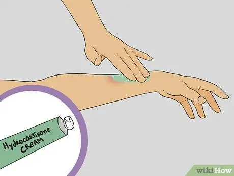 Treat a Bee Sting Step 12