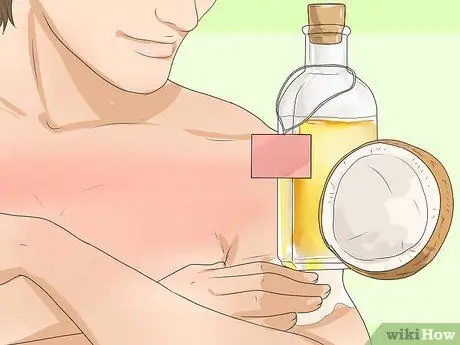 Turn Sunburn Into a Tan Step 11