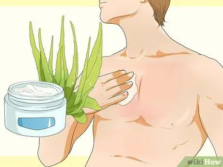 Turn Sunburn Into a Tan Step 2