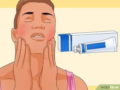 Turn Sunburn Into a Tan Step 5