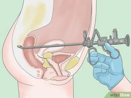 Detect Blood in Urine Step 7