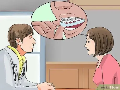 Whiten Your Teeth when You Have Braces Step 5