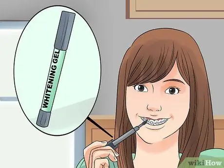 Whiten Your Teeth when You Have Braces Step 6