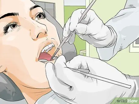 Treat a Tooth Abscess Step 7