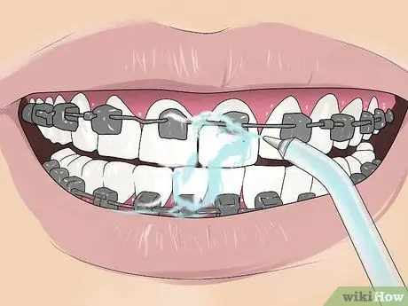 Floss with Braces ደረጃ 12