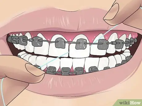 Floss with Braces ደረጃ 6