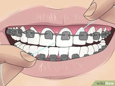 Floss with Braces ደረጃ 9