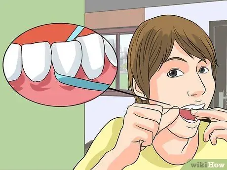 Remove Yellow Between the Teeth Step 1