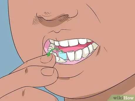 Pull out a Loose Tooth Step 1