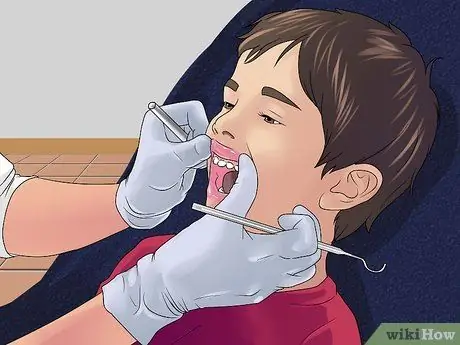 Stop the Bleeding After You Pull out a Loose Tooth Step 7