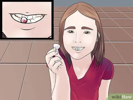 Stop the Bleeding After You Pull out a Loose Tooth Step 9