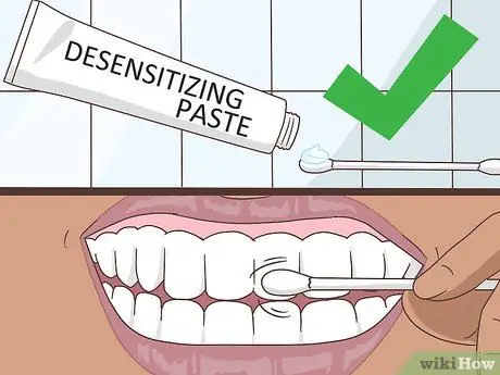 Hacer frente a la sensibilidad al blanqueamiento dental Paso 2