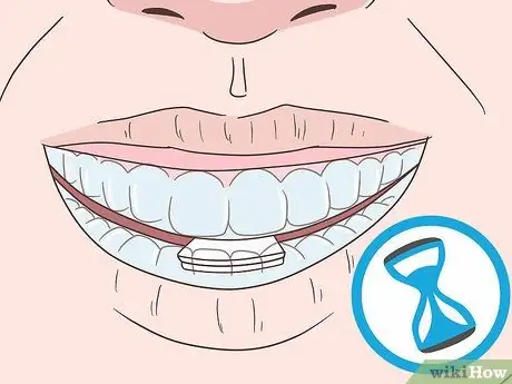 Cope with Teeth Whitening Sensitivity Step 7