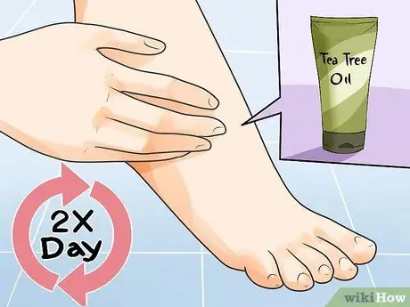 Cure Athlete's Foot Naturally Step 12