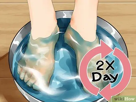 Cure Athlete's Foot Naturally Step 7