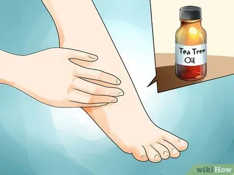 Cure Athlete's Foot Naturally Step 9