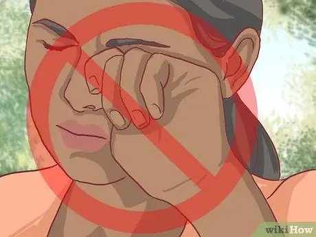 Treat Eczema Around the Eyes Step 11