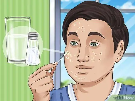 Get Rid of a Zit Overnight Step 4