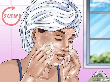 Get Rid of a Zit Overnight Step 12