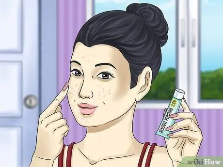 Get Rid of a Zit Overnight Step 1