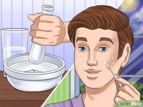 Get Rid of a Zit Overnight Step 6