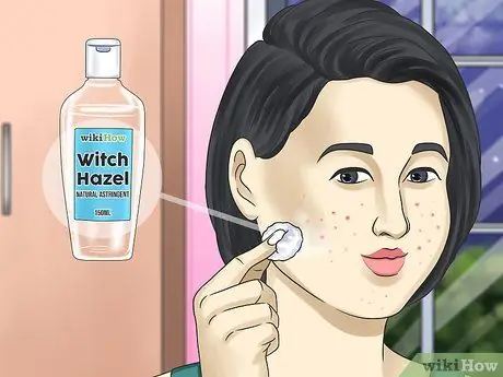 Get Rid of a Zit Overnight Step 7