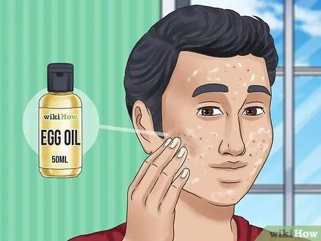 Get Rid of a Zit Overnight Step 8