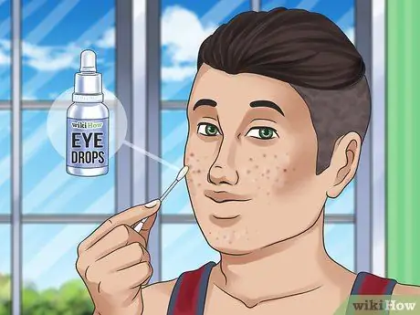 Get Rid of a Zit Overnight Step 10