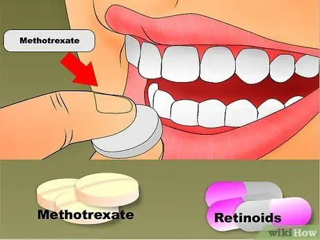 Heal rød hud Trinn 15