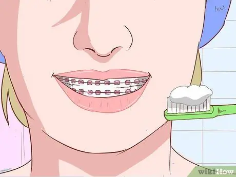 Avoid Pain When Your Braces Are Tightened Step 12